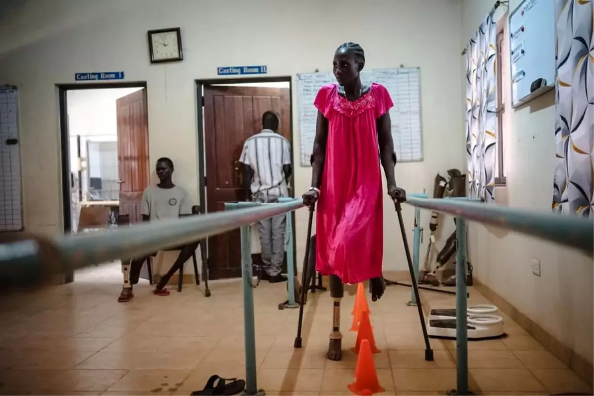 Güney Sudan’da Engellilere Rehabilitasyon Desteği