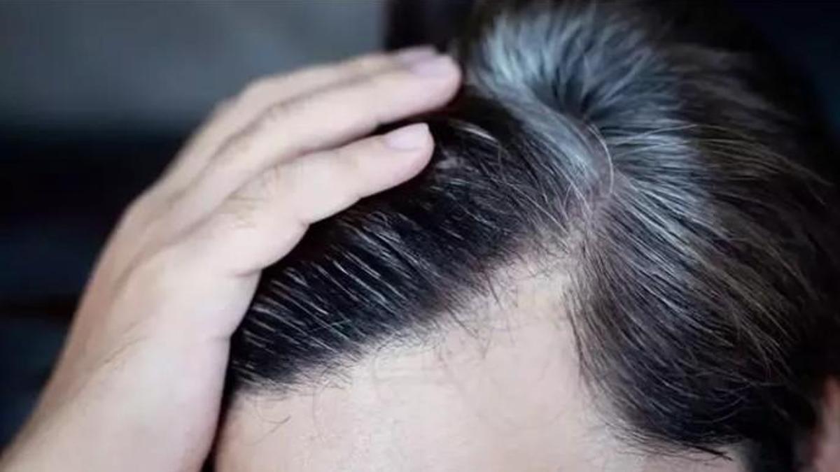 Luteolin açısından zengin sebzeler, saç beyazlamasını geciktiriyor