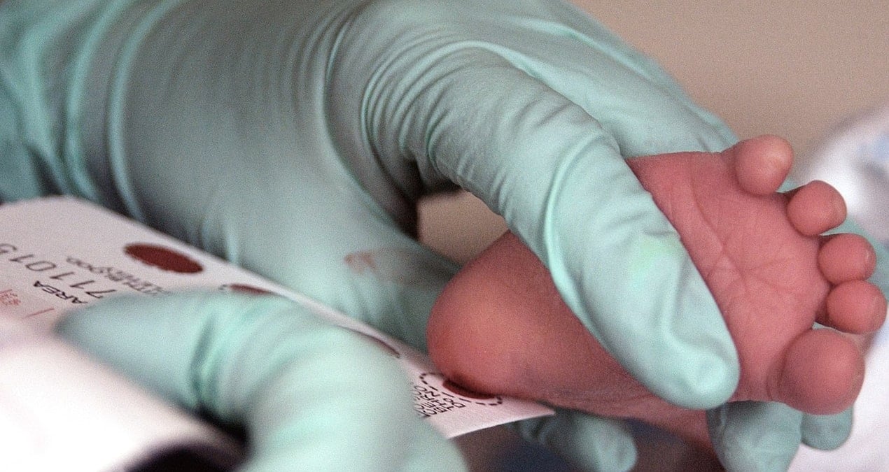 Ailelere ‘topuk kanı testi’ uyarısı