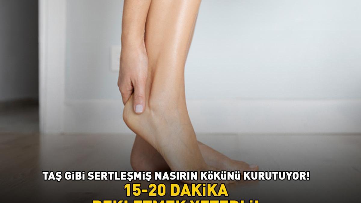 Taş gibi sertleşmiş nasırın kökünü kurutuyor! ’15-20 dakika bekletmek yeterli!’